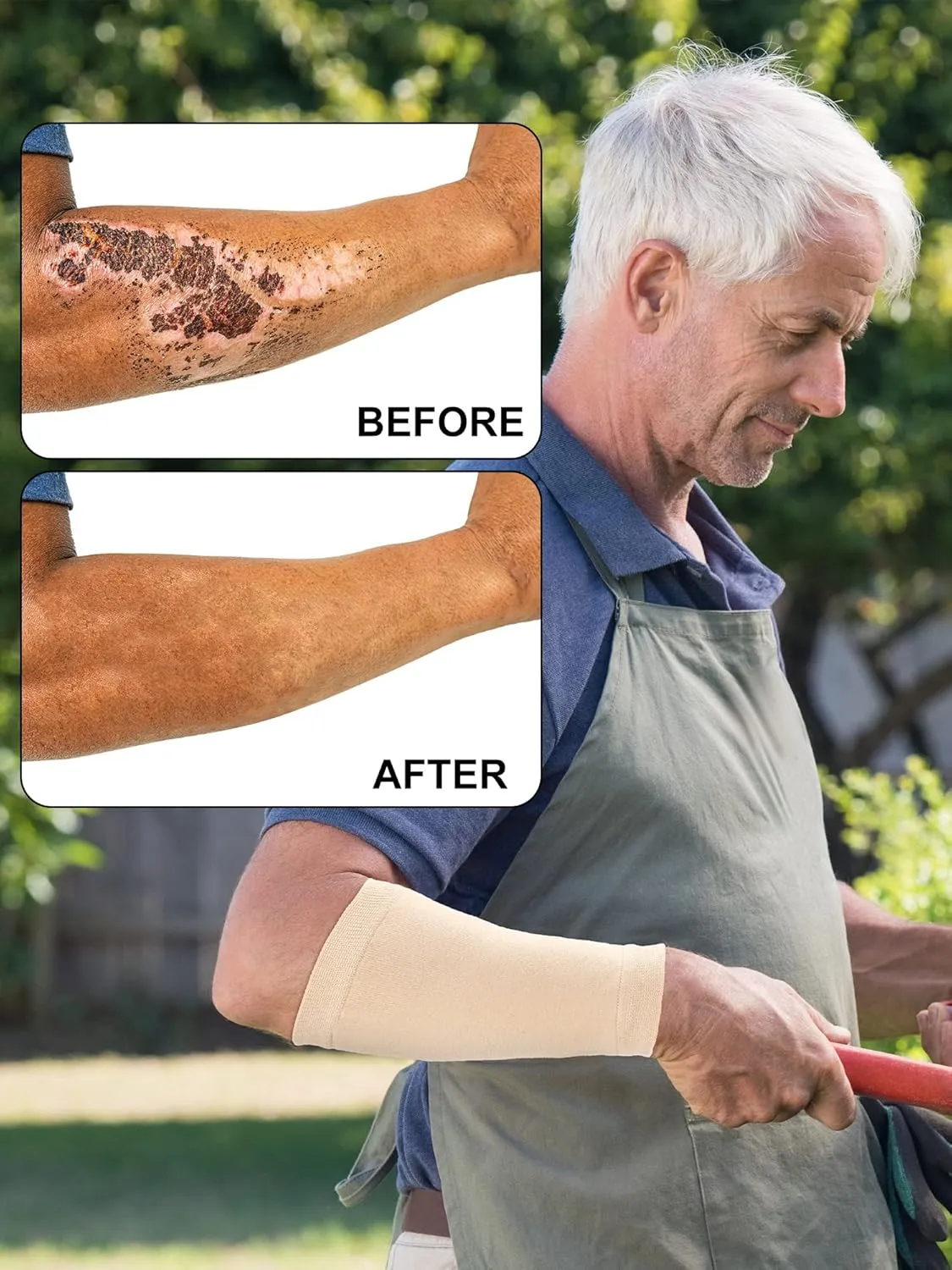 Janmercy 9 Pairs Arm Protectors for Thin Skin and Bruising Arm Guards Elderly Protective Sleeves for Gardener Working